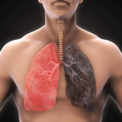 A-Trusted-Pulmonology-Billing-Services-Provider
