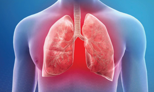 Expertise-In-CPT,-ICD-10,-HCPC-Pulmonology-Codes